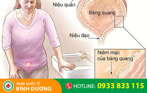 Viêm đường tiết niệu nữ gây ra nhiều biến chứng nguy hiểm