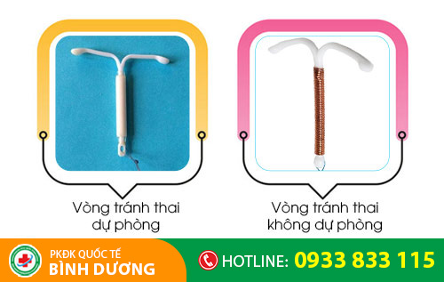 Các loại vòng tránh thai