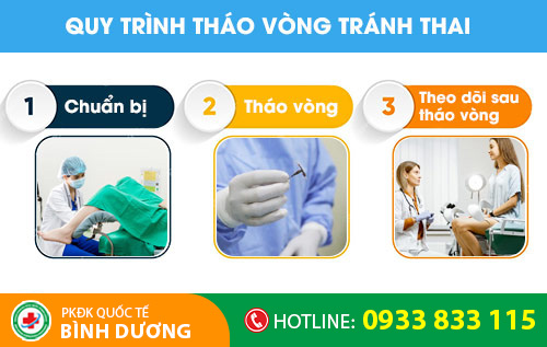 Quy trình tháo vòng tránh thai