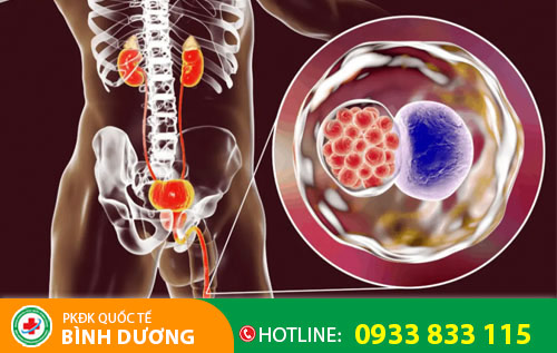 Bệnh Chlamydia