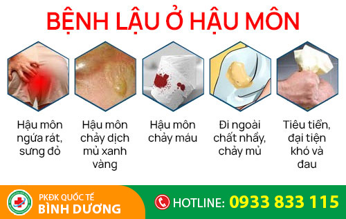 benh lau o hau mon