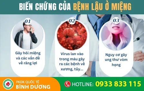bien chung benh lau o mieng