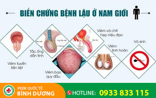 Biến chứng bệnh lậu ở nam giới
