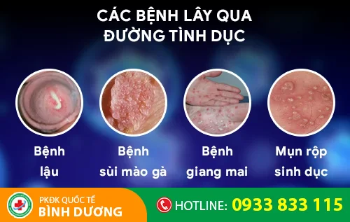 cac benh lay qua duong tinh duc