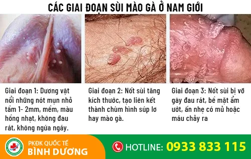 cac giai doan sui mao ga o nam gioi