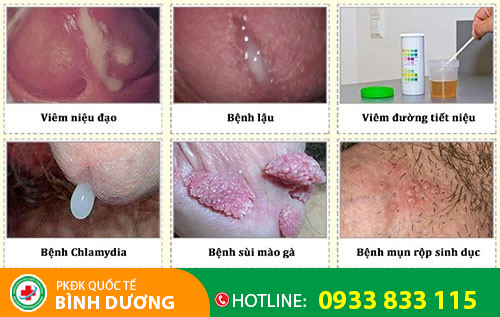 Niệu đạo chảy mủ là dấu hiệu của nhiều bệnh lý nguy hiểm