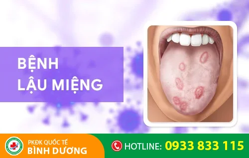 dau hieu nhan biet benh lau o mieng