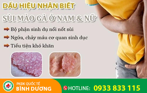 Sùi mào gà ở nam và nữ