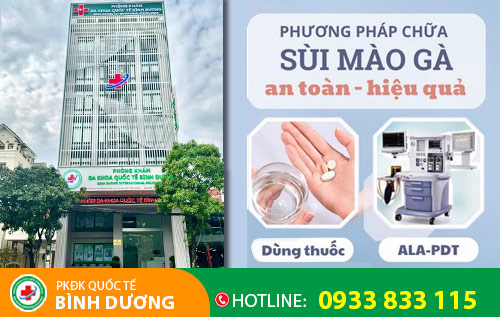 Địa chỉ hỗ trợ chữa sùi mào gà uy tín