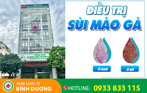 Phòng Khám Đa Khoa Quốc Tế Bình Dương - Địa chỉ chữa bệnh hoa khế uy tín