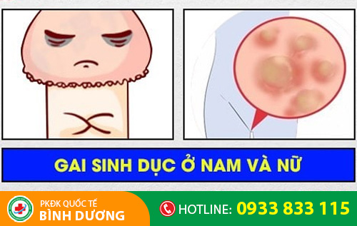 gai sinh dục ở nam và nữ