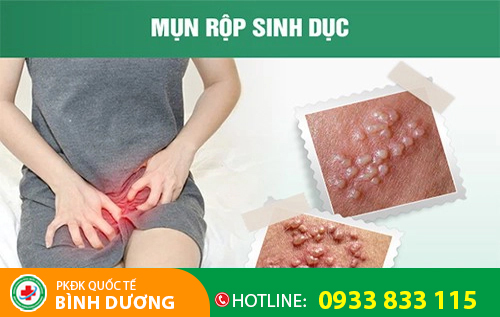 Hình ảnh cho virus HSV