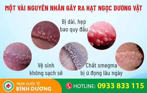 nguyen nhan gay ra hat ngoc duong vat