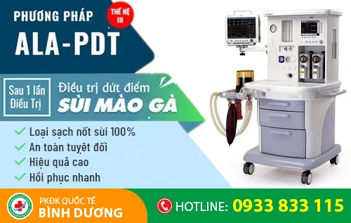 phuong phap dot dien cai tien moi dieu tri sui mao ga