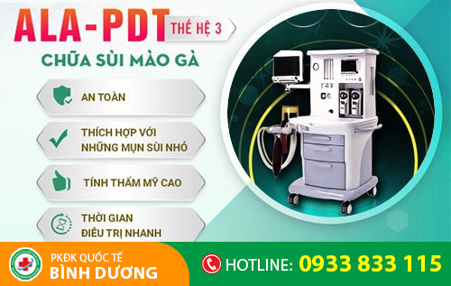 Điều trị sùi mào gà bằng phương pháp đốt điện cải tiến mới