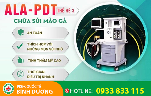 Phương pháp đốt điện chữa trị sùi mào gà an toàn, hiệu quả