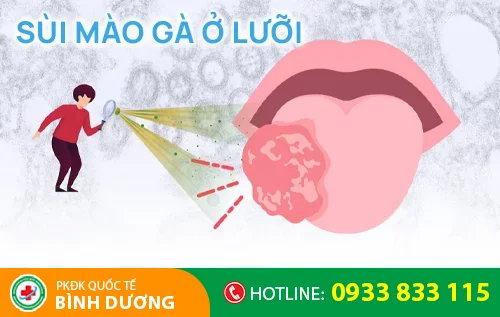 sui mao ga o luoi