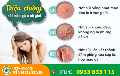 Sùi mào gà ở môi lớn, môi bé