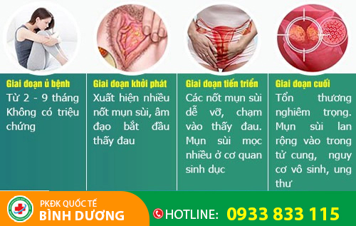 Sùi mào gà ở nữ có thời gian ủ bệnh ngắn hơn
