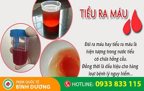Nguyên nhân gây tiểu buốt ra máu