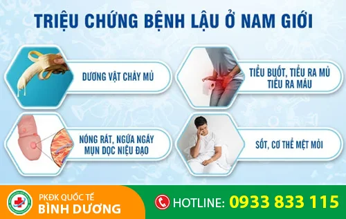 trieu chung benh lau o nam gioi