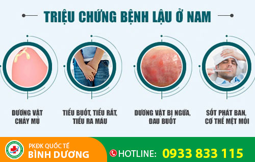 Triệu chứng bệnh lậu ở nam giới