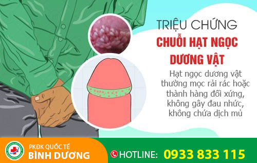 Triệu chứng chuỗi hạt ngọc dương vật
