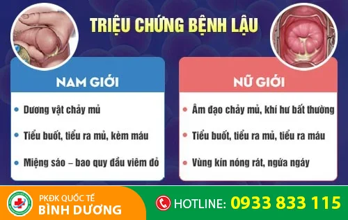 trieu chung benh lau