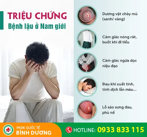 trieu chung lau o nam gioi
