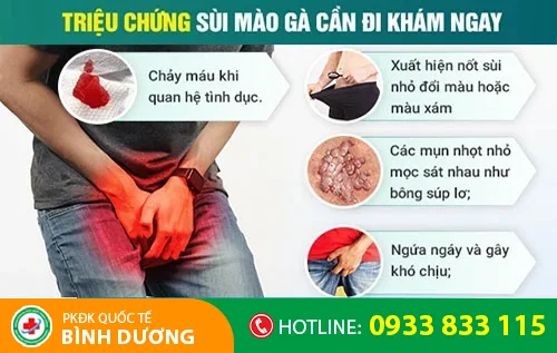 trieu chung sui mao ga can di kham ngay