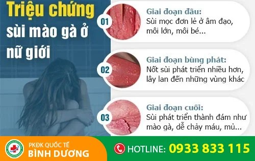 trieu chung sui mao ga o nu gioi