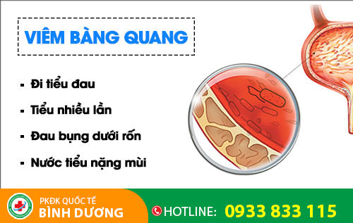 Triệu chứng viêm bàng quang